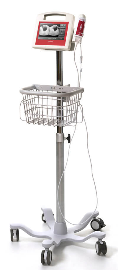 Máy Siêu Âm Bàng Quang (Portable-Battery)